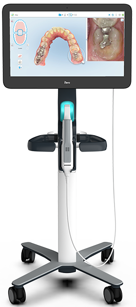 Scanner intraoral iTero utilizado na clínica de odontologia digital no Tatuapé